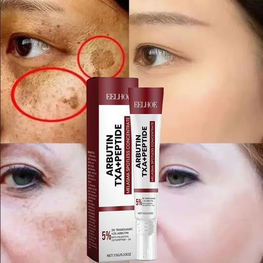 Face Cream Remove Melasma Dark Spot