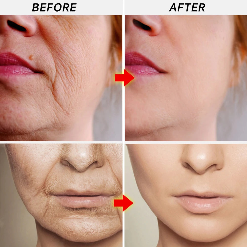 Instant Remove Wrinkle Serum Remove wrinkles Firm Lifting